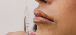 Lip filler treatment at 88 Wellness & Aesthetics in Burleson TX